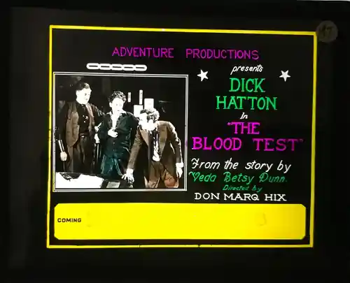 Blood Test photo